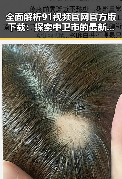 全面解析91视频官网官方版下载：探索中卫市的最新娱乐资源